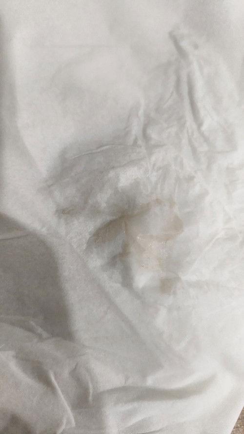 Cairan dari jalan lahir