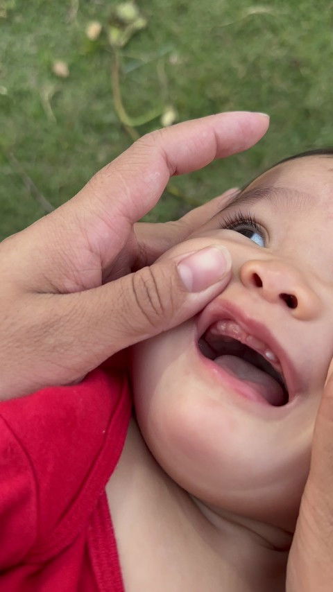 ฟันซี่แรกของลูกขึ้นตรงข้างๆฟันหน้า ทั้งสองข้าง ผิดปกติไหมคะ ? น้องอายุ 10 เดือน