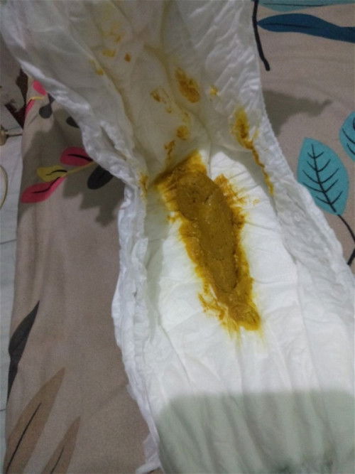 Frekuensi dan Tekstur Fases bayi ASI 4 bulan