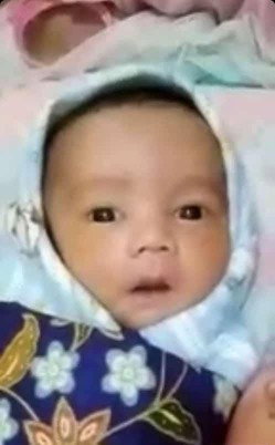 Bayi kuning