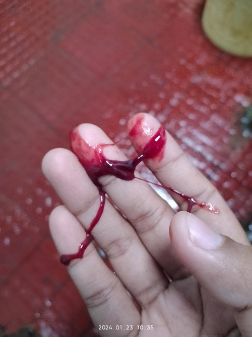 Apakah keguguran?