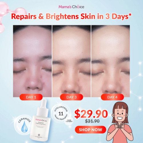 Bye-bye Acne Scars, Hello Glowy Skin! 🤗