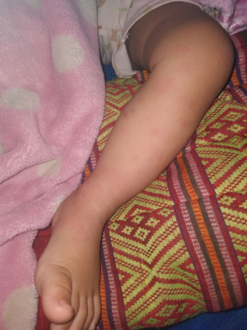 สอบถามหน่อยแม่ค่ะ เป็นอะไรค่ะ