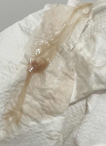 Please help! Spotting at 6w