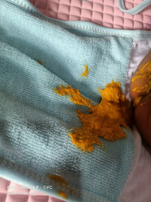 BAB 3-4 kali sehari apakah normal