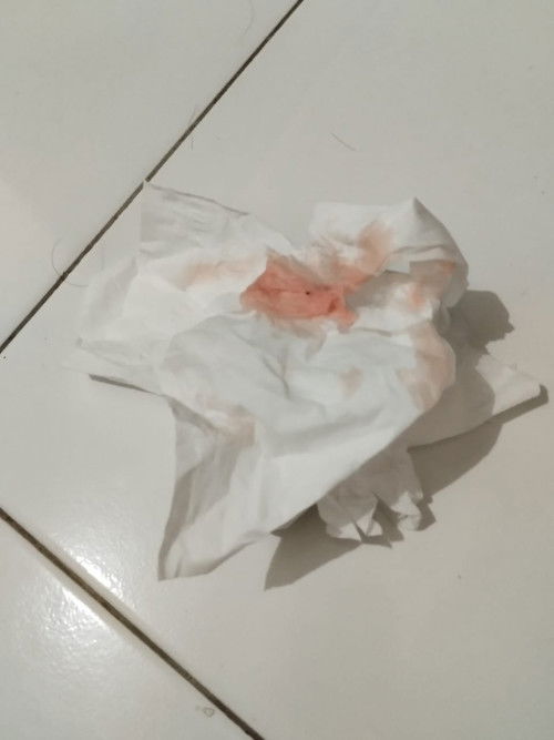 keluar bercak darah