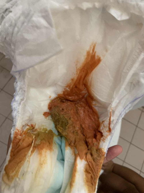 Tahi / najis warna oren terang