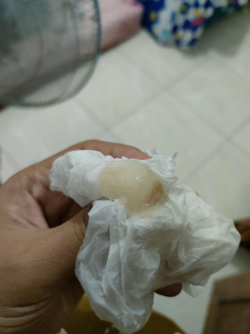 Hpl 27 Januari, keluar lendir dan sedikit bercak