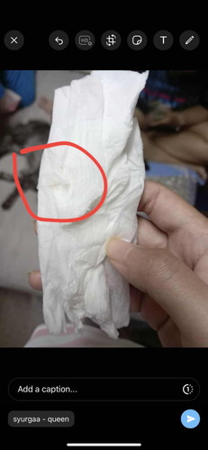 hai mummy , klau perut mengeras daa 3 hari perlu kea hospital kea ? 3 hari lps pun memang ada drh