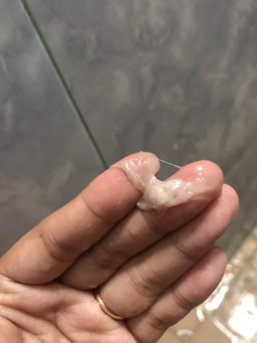 Cairan keluar uk 37 minggu 1 hari