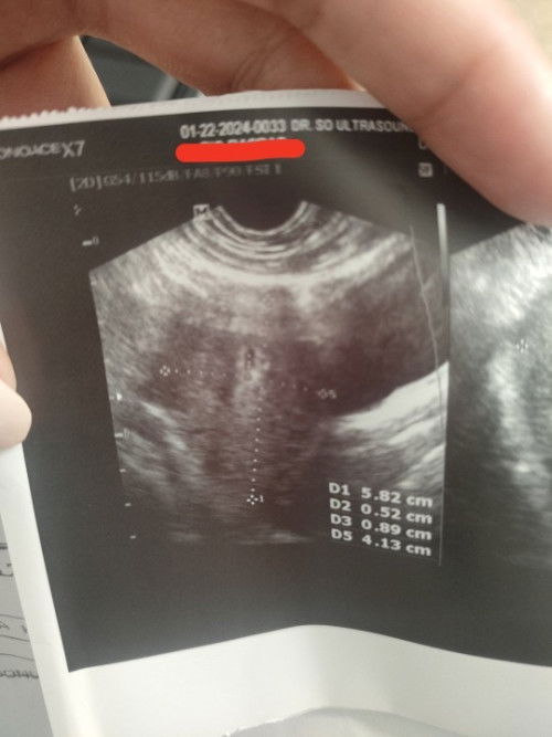 7-8 Weeks Ultrasound