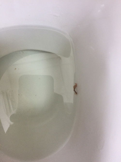 Hamil 7-8 weeks tapi Flek Coklat tanpa sakit perut