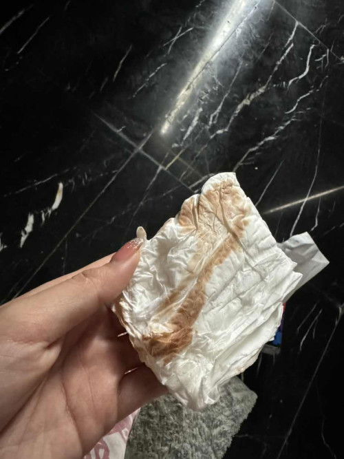 ภาวะแท้งคุกคาม