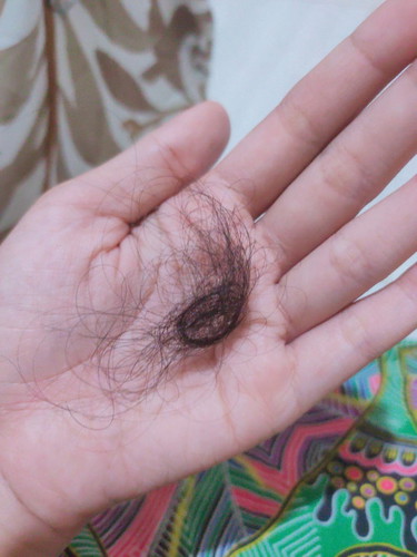 Rambut Rontok Busui
