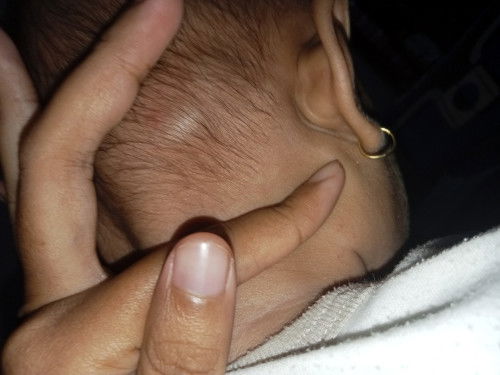 Jendolan di belakang kepala bayi