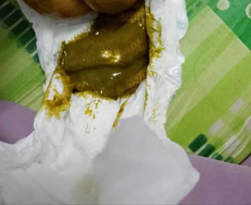 Warna Najis Baby