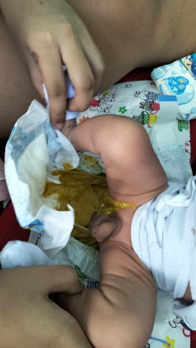 Kulay ng tae ni baby