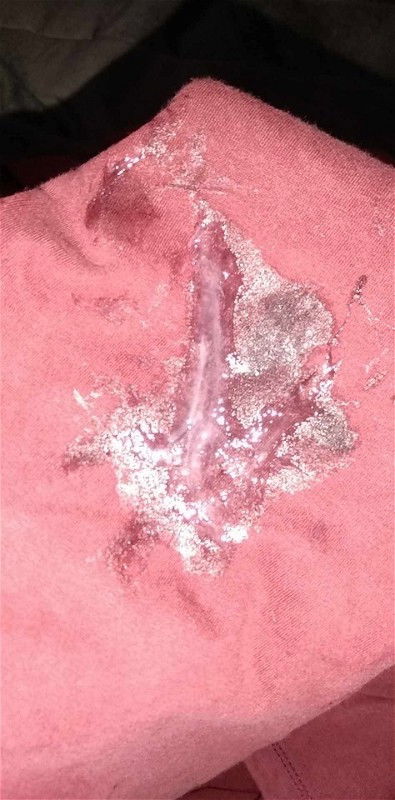 ขออภัยในภาพที่ไม่เหมาะสมด้วยนะคะ🙏🏻