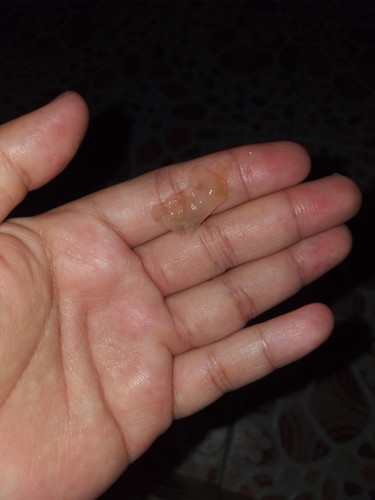 มีมูกสีขาวปนน้ำตาลนิดหน่อย