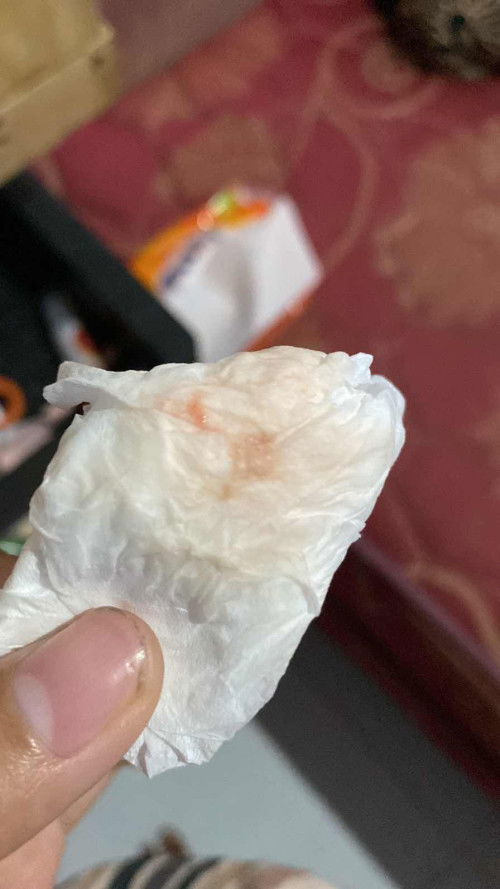 Mau tanya ini apa tanda” mau lahir atau air ketuban ya