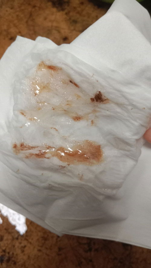 Hamil 9 week 2 hari, keluar darah saat muntah