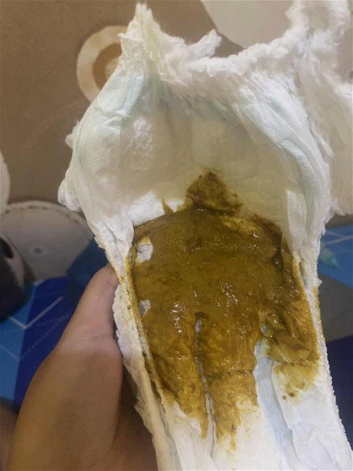 POOP BAYI 4BLN BERBUSA DAN BERLENDIR