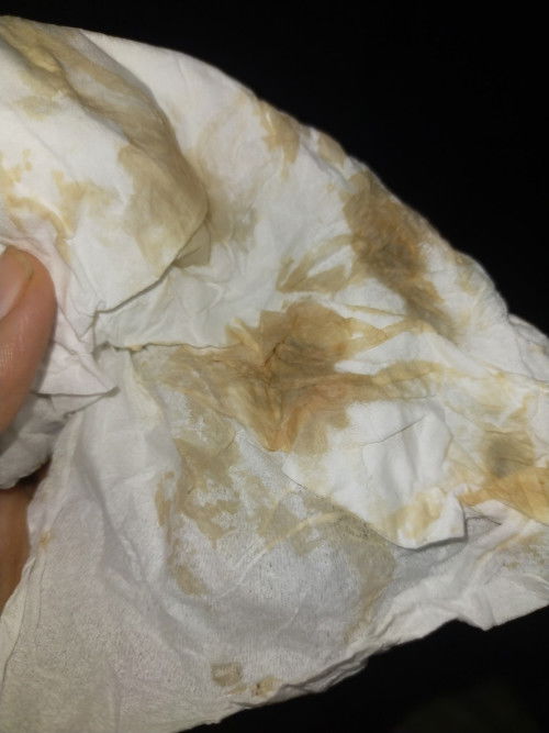 Bunda mau nanya nih,saya hamil 11 Minggu tiba2 perut saya nyeri sedikit sekali ,perut sedikit tegang