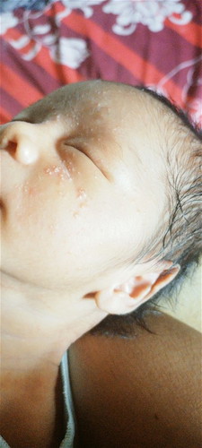 Bantu jawab dong bun