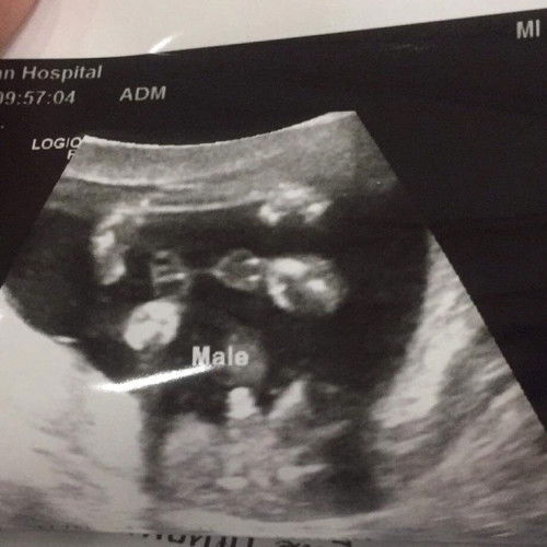 อยากรู้ว่าผู้หญิงหรือผู้ชาย