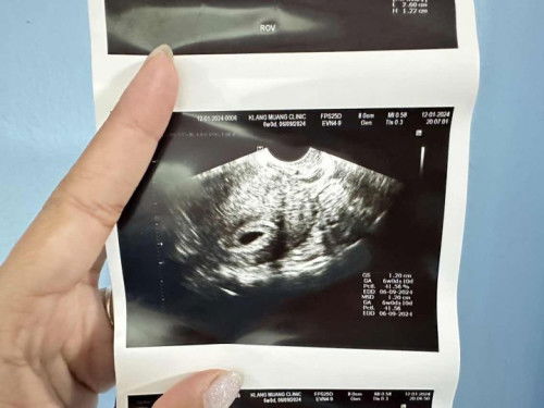 รบกวนสอบถามแม่ๆ มีแม่ๆคนไหนเคยเจอเหตุการณ์แบบนี้บ้างไหมคะ