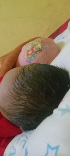Kepala bayi lembek
