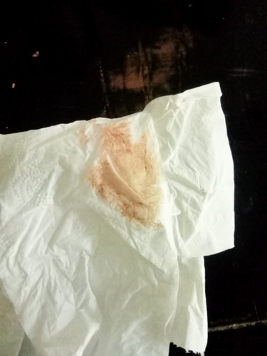 ใช่เลือดล้างหน้าเด็กไหม