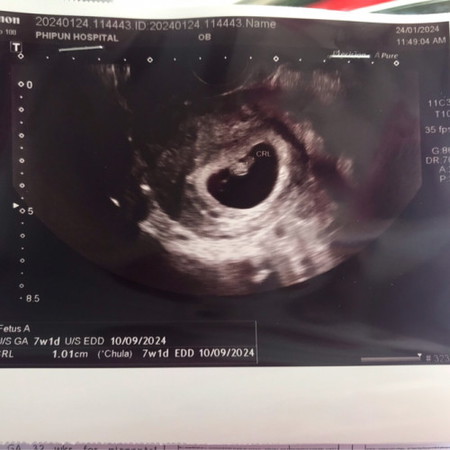 7 week 3 day