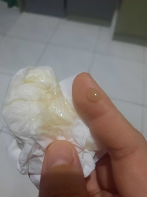 Lendir kental
