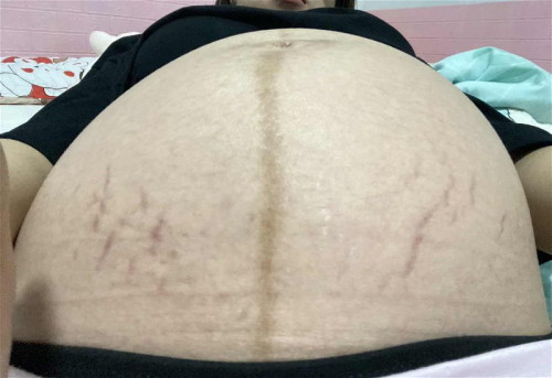 33week 🥲แล้วค่า