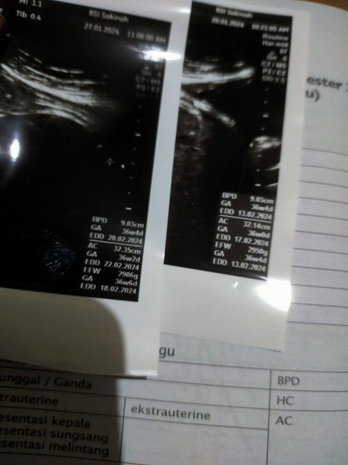 Bbj dan usia kehamilan