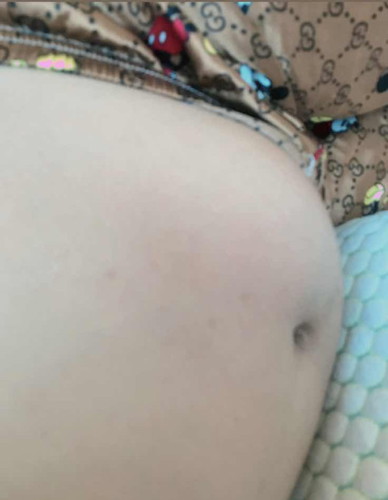 ลักษณะแบบนี้คืออะไรคะ