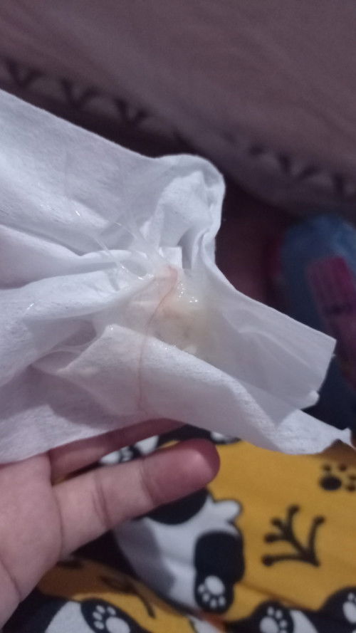 Maaf bund rada jorok.. UK 38w kencing malah keluar begini d CD ini kenapa ya, apa efek hb sama suami