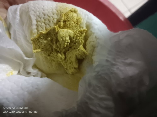 Adkah tahi ini normal utk bayi 23 hari.ank sya mnum susu dutch baby tpi sblm ini lactogen .