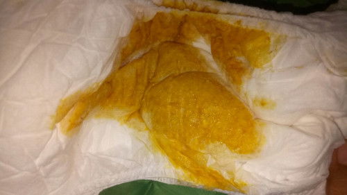 Bayi umur 2 bulan pop sehari 5 kali