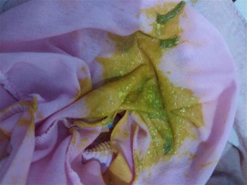 bayiku usia 5 bulan 22 hri, bbrpa hari ini stiap hri BAB