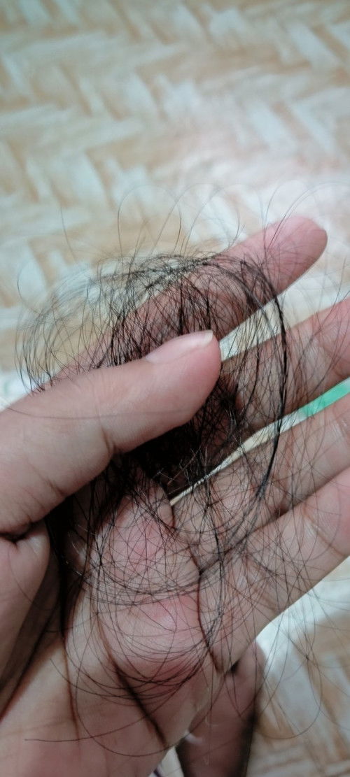 Hair fall after manganak