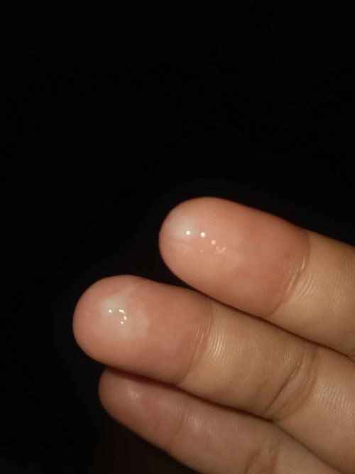 มีตกขาวออกมาแบบนี้ คืออะไรคะ