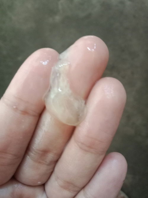 แบบนี้ใช่มูกใสมั้ยค่ะ