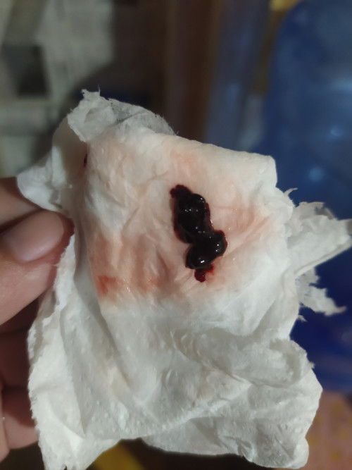 UK 39 minggu 5 hari keluar gumpalan darah