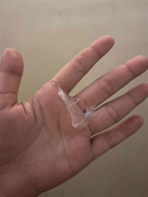 แบบนี้คืออะไรคะ 39week เข้าห้องน้ำแล้วอันนี้ไหลออกมา
