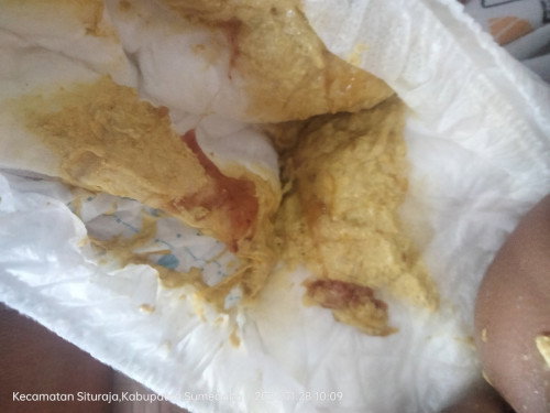 BAB BAYI 5 BLN 13 HARI