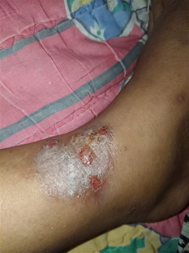 Hi ibu2 sekalian, Nak tnya apa ubat untuk ni.. Mana thu ada yg pernah mngalami bnda sama dgn sa..