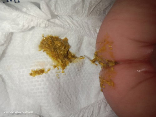 ANO PO KAYA IBIG SABIHIN KAPAG GANTO ANG POPO NI BABY?