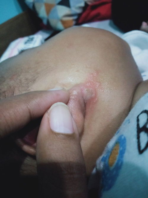 Bun ada yang tau gk ini knp ya kira* btu tau td mlm jd kawatir soalnya pertma kli 🥹